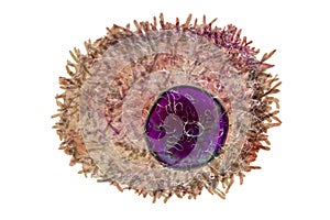 Plasma cell, a white blood cell, differenciated B lymphocyte that secretes antibodies