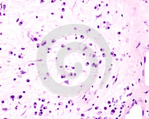 Plasma cells photo