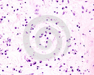 Plasma cells photo