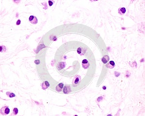 Plasma cells photo