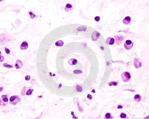 Plasma cells photo