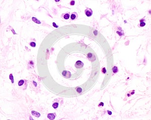 Plasma cells photo