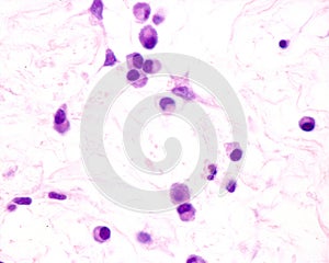 Plasma cells photo