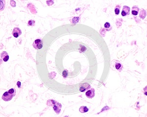 Plasma cells photo