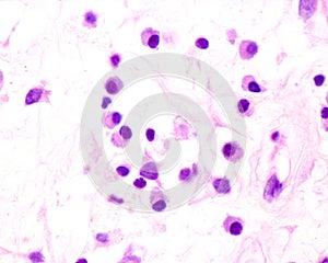 Plasma cells photo