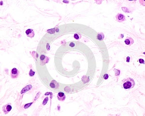 Plasma cells photo