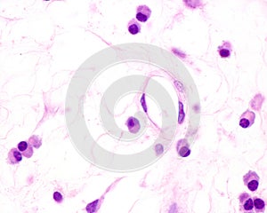 Plasma cells photo
