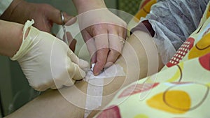 Plasmapheresis. Cleaning the patientâ€™s blood through the device. A nurse inserts a medicine drip into a patient`s vein