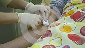 Plasmapheresis. Cleaning the patientâ€™s blood through the device. A nurse removes a catheter from a patient`s vein