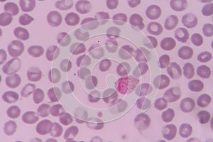 Plasmodium