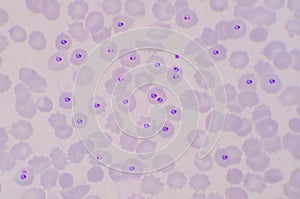 Plasmodium blood parasite ring form stage infected redblood cells