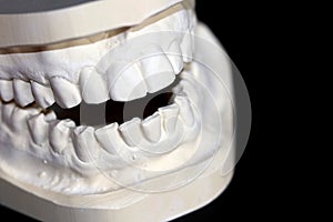 Plaster cast from above and lower teeth of human