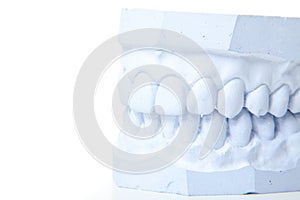 Plaster cast of perfect teeth