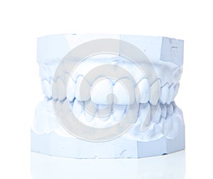 Plaster cast of perfect teeth