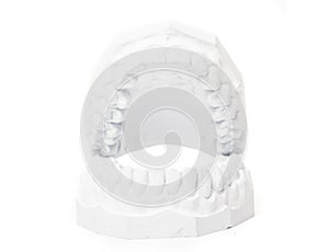 Plaster cast of teeth