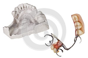 Plaster cast of teeth and dentures