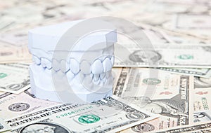 Plaster cast of teeth on dollar notes