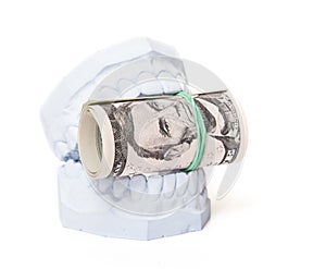 Plaster cast of teeth with dollar notes