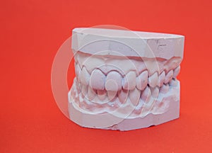 Plaster cast of teeth