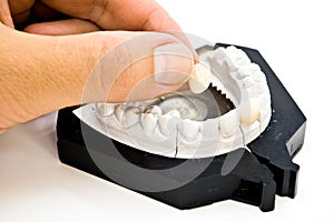 Plaster dental mold photo