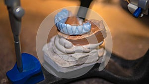 Plaster model of teeth, the work of a dental technician, tools for dental prosthetics. Clinic for the manufacture of dental crowns