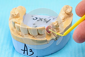 Plaster models of the jaws in the hands of a dental technician in a dental laboratory