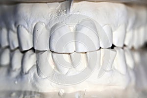 Plaster print of the human teeth