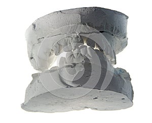 Plaster teeth cast