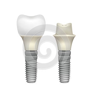 Plastic assembled tooth implant photo