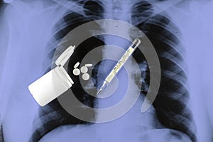 a plastic container with scattered pills and a thermometer on the background of an X-ray of the lungs
