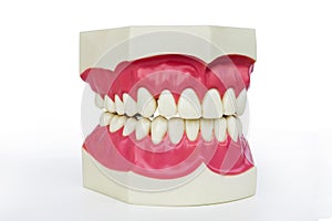 Plastic dentures