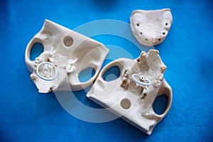 Plastic jaw model for stomatology and maxillofacial surgery.