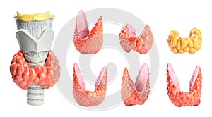 Plastic models of healthy and afflicted thyroid on white background, collage