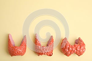 Plastic models of healthy and afflicted thyroids on beige background, flat lay. Space for text