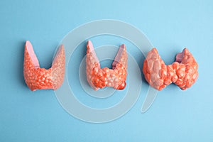 Plastic models of healthy and afflicted thyroids on light blue background, flat lay