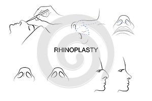 El plastico. cosmético cirugía 