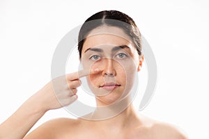 Plastic nose surgery. Portrait of young caucasian woman point her crooked bridge of the nose isolated on white