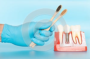 Plastic samples of dental implants compare with natural teeth
