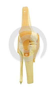 Plastic study model of a knee replacement clipping path.