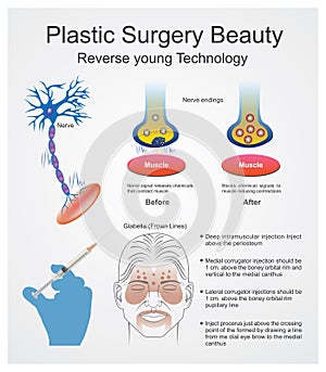 Plastic surgery beauty. Reverse young technology.