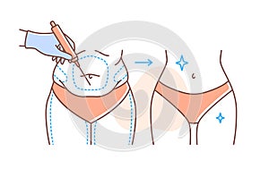 Plastic surgery body vector doodle