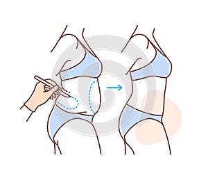 Plastic surgery body vector doodle