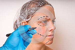 Plastic surgery doctor draw lines with marker on patient face