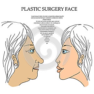 Plastic Surgery face 5