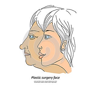 Plastic surgery face1