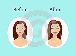 Plastic surgery before and after illustration. Portrait of beautiful girl in cartoon style.
