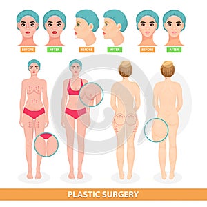 Plastic surgery vector patient woman before surgical operation facelifting or facial anti aging lift surgically or photo