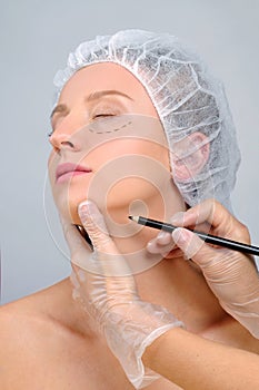 Plastic surgery. Woman with perforation lines on the face. Anti-aging treatment and face lift