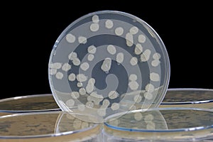 Plate Bacteria culture growth on Selective media
