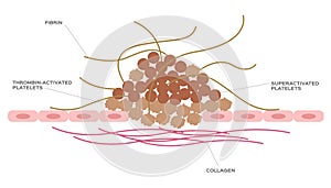 Platelet and fibrin on wound